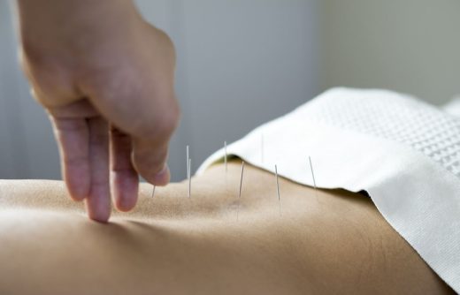 Acupuncteur Au Travail Sur Une Patiente